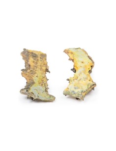 Multiple polyposis - Erler Zimmer 3D anatomy Series MP2070 2