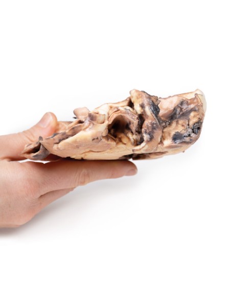 Rheumatische Endokarditis - Erler Zimmer 3D-Anatomie Serie MP2039