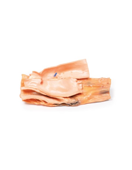 Fistola traumatica esofageo-aortica - Erler Zimmer 3D anatomy Series MP2040