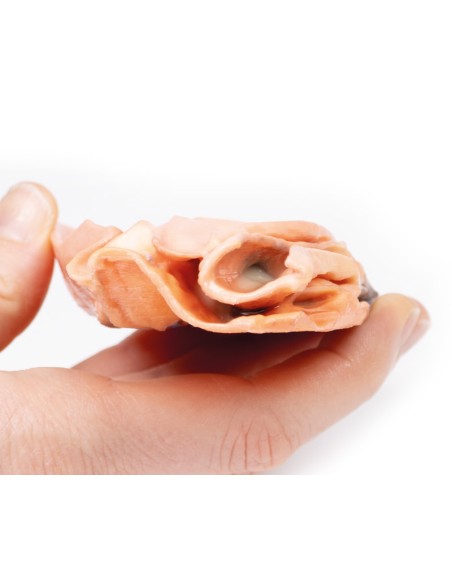 Fistule oesophago-aortique traumatique - Erler Zimmer 3D anatomy Series MP2040