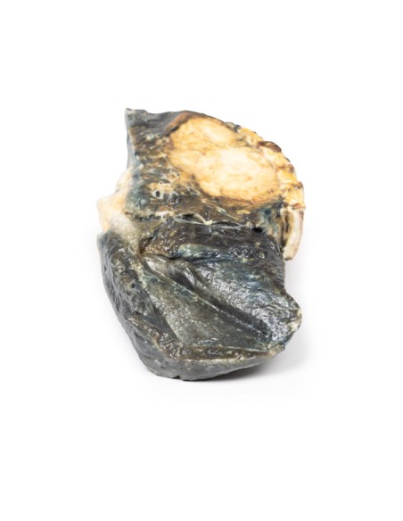 Tumeur métastatique dans le poumon à partir d'un cancer primaire du testicule - Erler Zimmer 3D anatomy Series MP2055