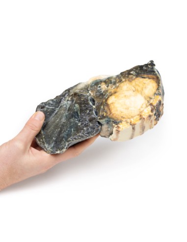 Metastatic tumor in the lung from primary...