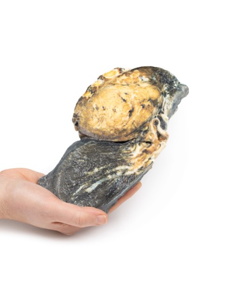 Tumeur métastatique dans le poumon à partir d'un cancer primaire du testicule - Erler Zimmer 3D anatomy Series MP2055