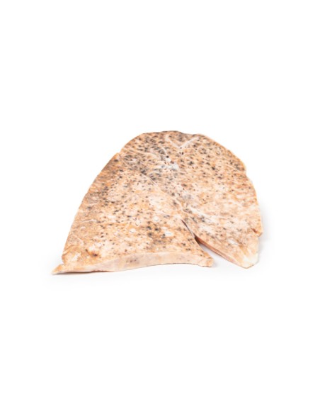 Tuberculosis miliar del pulmón derecho - Erler Zimmer 3D anatomy Series MP2060