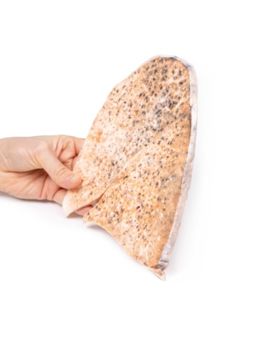 Milvian tuberculosis of the right lung - Erler...