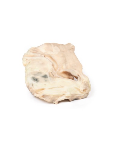 Trachée : lymphome hodgkinien- Erler Zimmer 3D...