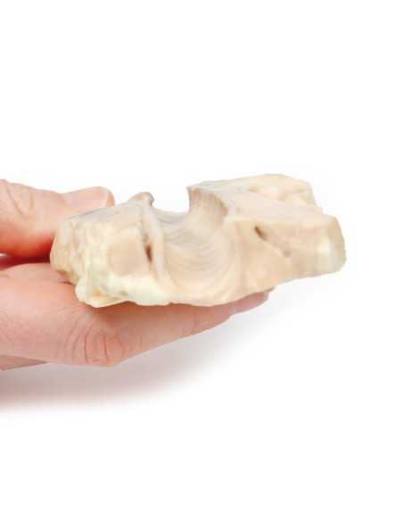 Trachea: linfoma di Hodgkin- Erler Zimmer 3D anatomy Series MP2062