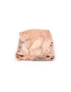 Chronic gastric ulcers - Erler Zimmer 3D anatomy Series...