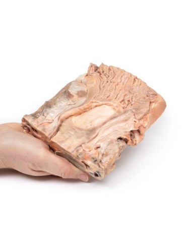 Chronic gastric ulcers - Erler Zimmer 3D...