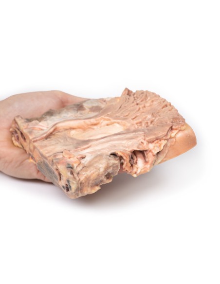 Ulcères gastriques chroniques - Erler Zimmer 3D anatomy Series MP2076