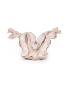 Unicollis bicornuate uterus - Erler Zimmer 3D anatomy...