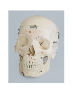 Erler Zimmer, anatomisches Modell eines in 14 Teile...