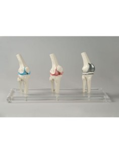 Erler Zimmer, modèle anatomique de l'articulation du...