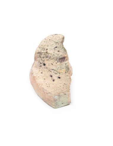 Cirrhose du foie - Erler Zimmer 3D anatomy...
