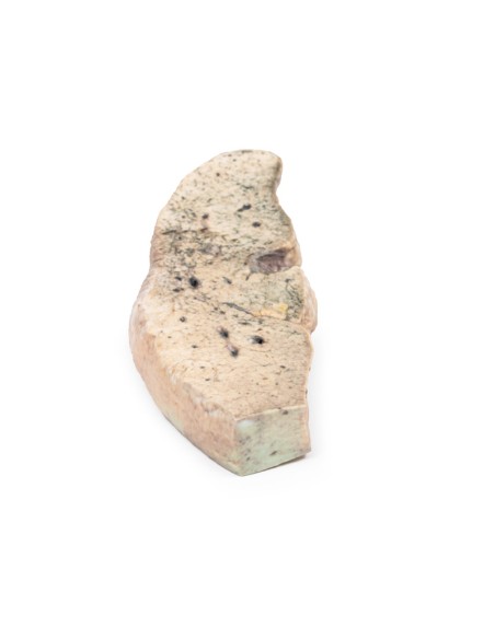 Cirrhose du foie - Erler Zimmer 3D anatomy Series MP2073