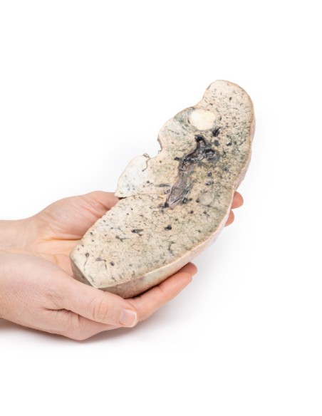 Cirrhosis of the liver - Erler Zimmer 3D anatomy Series MP2073