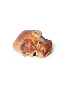 Nerfs faciaux superficiels et glande parotide - Erler... 2