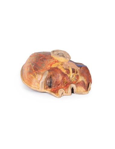 Superficial facial nerves and parotid gland -...