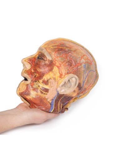 Superficial facial nerves and parotid gland -...