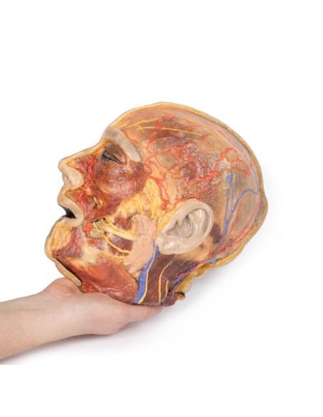 Oberflächliche Gesichtsnerven und Ohrspeicheldrüse - Erler Zimmer 3D-Anatomie Serie MP1109