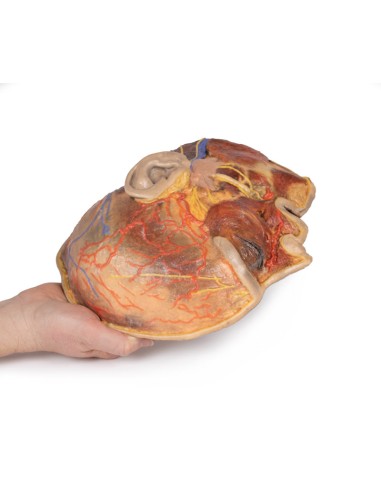 Superficial facial nerves and parotid gland -...
