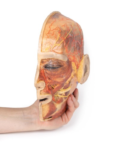 Superficial facial nerves and parotid gland -...