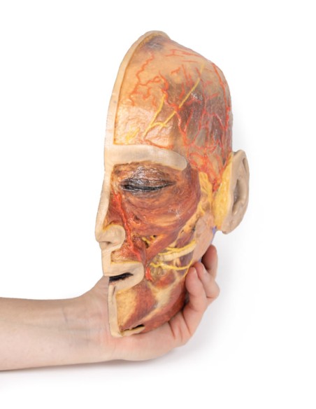 Oberflächliche Gesichtsnerven und Ohrspeicheldrüse - Erler Zimmer 3D-Anatomie Serie MP1109