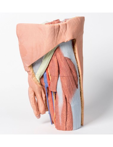 Male left pelvis and proximal thigh - Erler...