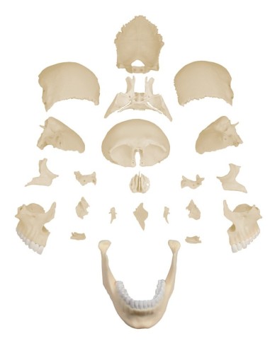 Erler Zimmer, 22-part decomposable white skull...