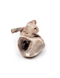 Tetralogy of Fallot - Erler Zimmer 3D anatomy Series MP2037 2