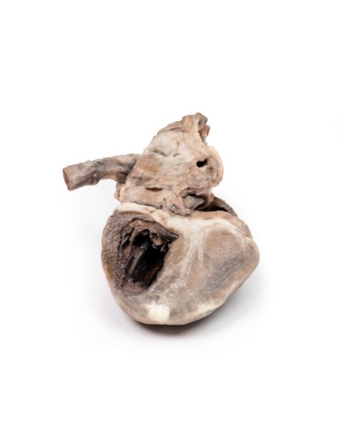 Tétralogie de Fallot - Erler Zimmer 3D anatomy...