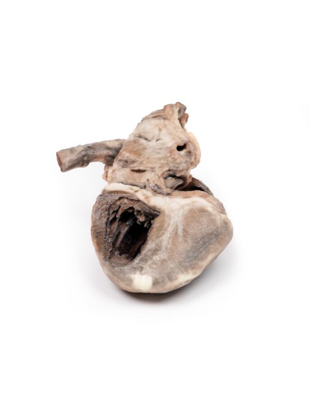 Tétralogie de Fallot - Erler Zimmer 3D anatomy Series MP2037