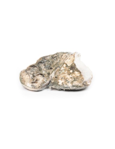 Tuberculosis fibrocaseosa - Erler Zimmer 3D...