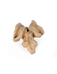 Encephalic trunk, deep brain and diencephalic structures...