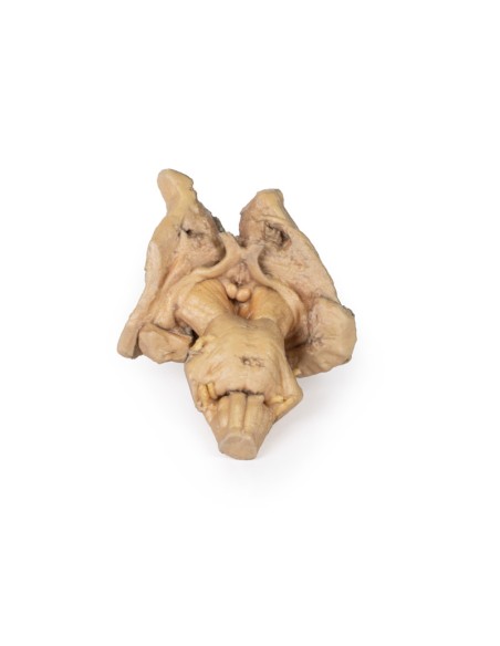 Encephalic trunk, deep brain and diencephalic structures - Erler Zimmer 3D anatomy Series MP1100