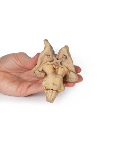 Encephalic trunk, deep brain and diencephalic...