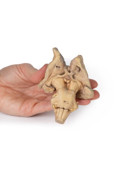 Encephalic trunk, deep brain and diencephalic structures - Erler Zimmer 3D anatomy Series MP1100