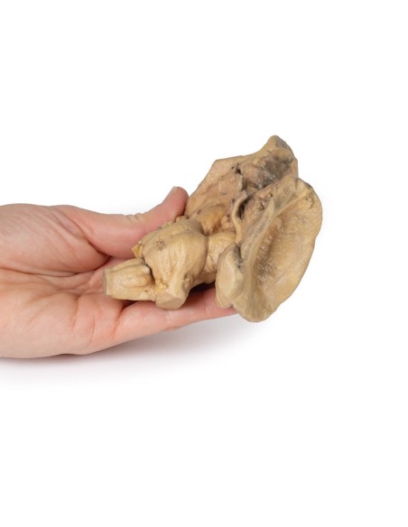 Encephalic trunk, deep brain and diencephalic structures - Erler Zimmer 3D anatomy Series MP1100