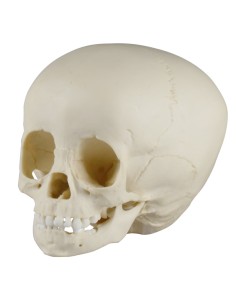 Skull of 1 1/2 year old child Erler Zimmer 4775 2
