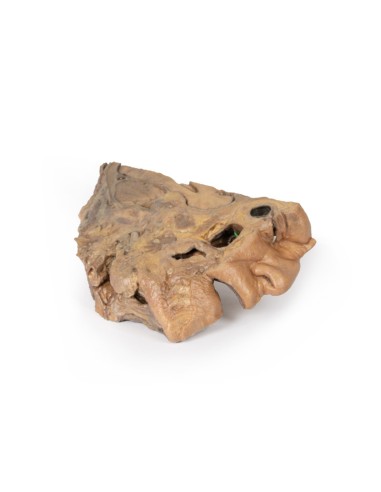 Voies du sinus paranasal - Erler Zimmer 3D...