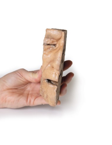 Bahnen der Nasennebenhöhlen - Erler Zimmer...