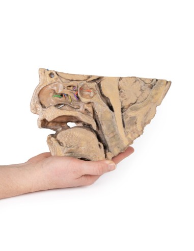 Voies du sinus paranasal - Erler Zimmer 3D...