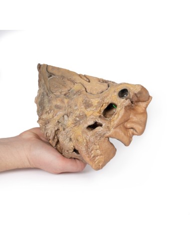 Bahnen der Nasennebenhöhlen - Erler Zimmer...