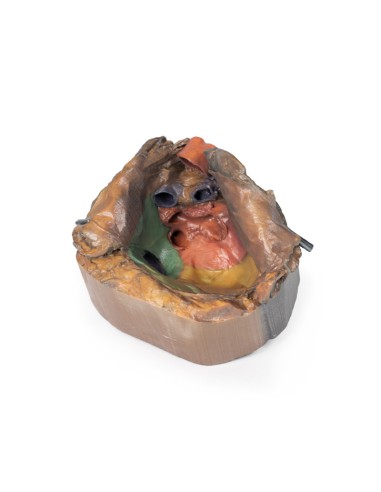 Spazio pericardico - Erler Zimmer 3D anatomy...