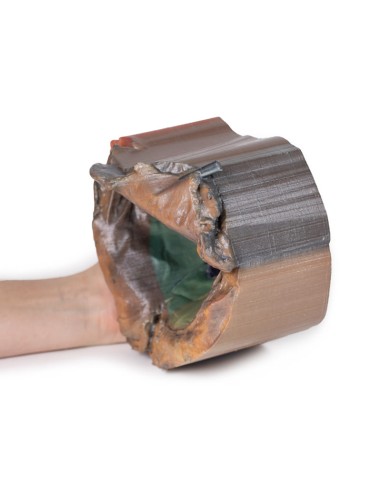 Spazio pericardico - Erler Zimmer 3D anatomy...