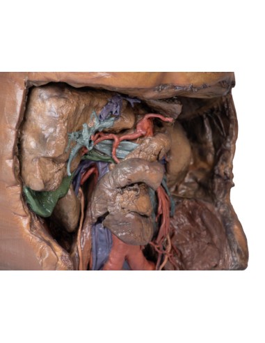 Abdominales Gefäßsystem - Erler Zimmer...