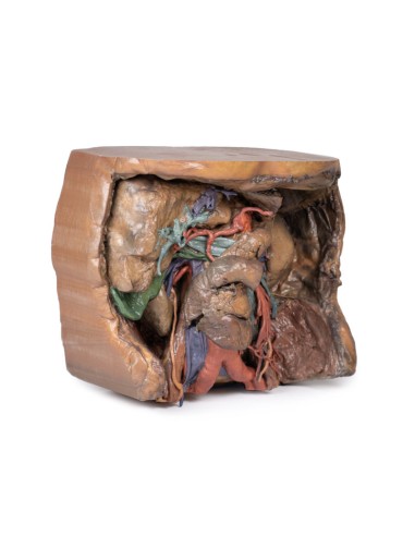 Vascularización abdominal - Erler Zimmer 3D...