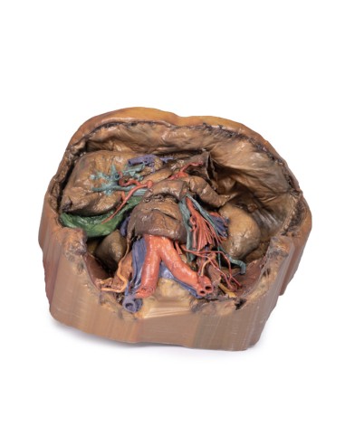 Vascolarizzazione addominale - Erler Zimmer 3D...