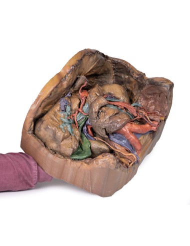 Abdominales Gefäßsystem - Erler Zimmer...