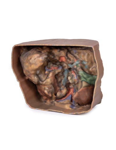 Vascularización abdominal - Erler Zimmer 3D...